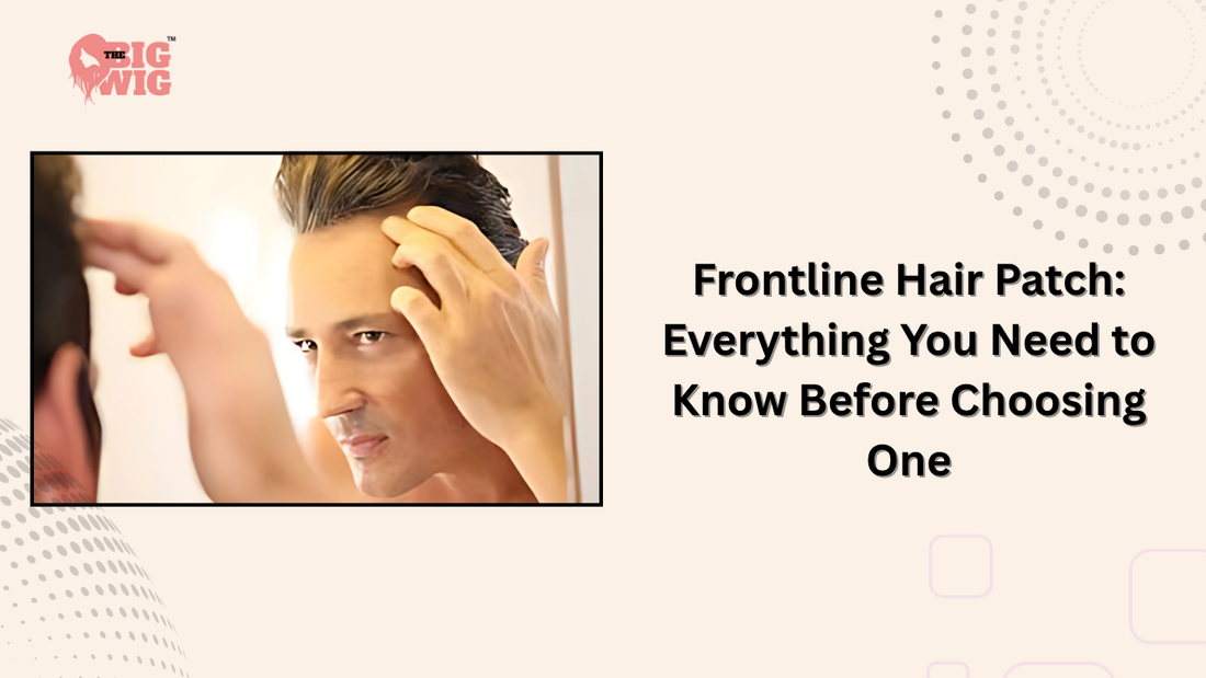 Frontline Hair Patch