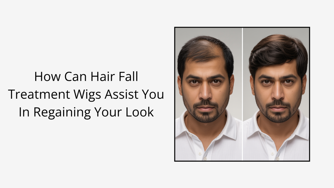 How Can Hair Fall Treatment Wigs Assist You In Regaining Your Look