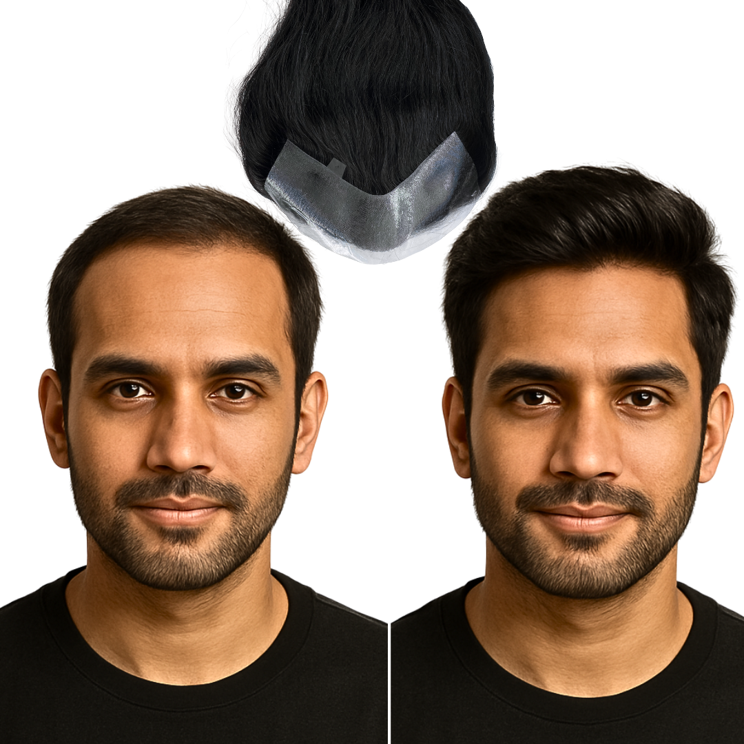 Frontline Hair Patch | 100% Original Human hair patch