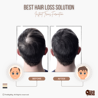 Premium Monofilament Hair Patch – Ultimate Quality and Realism