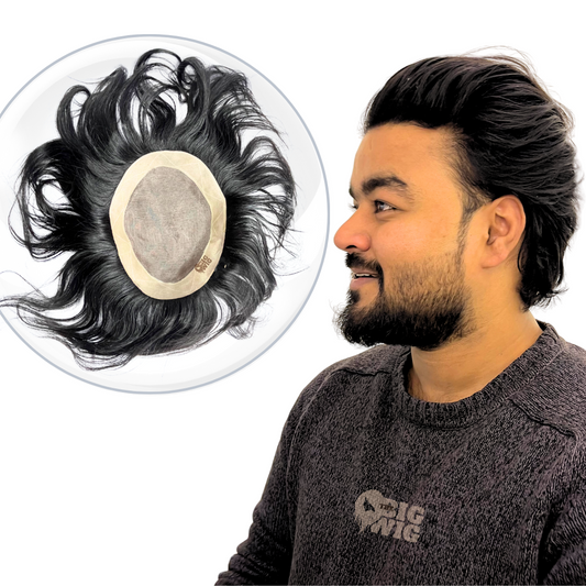 Alpha Monofilament Hair Patch – Superior Quality and Natural Appearance
